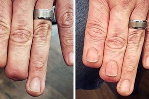 20 alkalom, amikor a tetoválóművészek tökéletesen tüntették el az anyajegyeket és a sérüléseket