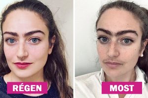 Egy nő abbahagyta az arcszőr eltávolítását, és egy évvel később megosztja, hogyan változtatta meg az életét