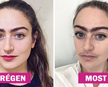 Egy nő abbahagyta az arcszőr eltávolítását, és egy évvel később megosztja, hogyan változtatta meg az életét Egy nő abbahagyta az arcszőr eltávolítását, és egy évvel később megosztja, hogyan változtatta meg az életét