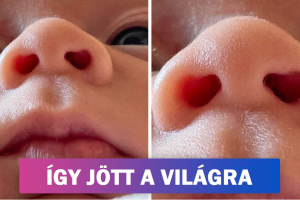 18 alkalom, amikor a természet kreatív volt és az embereket egyedi tulajdonságokkal jutalmazta