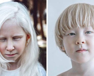 Egy fotós albinizmussal élő emberekről készít képeket, hogy bemutassa lenyűgöző és egyedi szépségüket