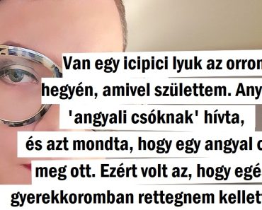 20+ lány, akik végre elfogadták a nem szokványos orrukat és most igazán boldogok