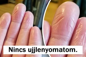 20 ember, aki felfedezett valami egyedit a testén