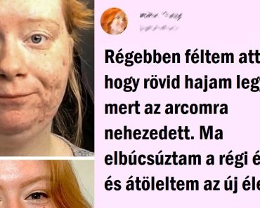 13 ember, akik elfogadták tökéletlenségeiket és elkezdtek teljes életet élni