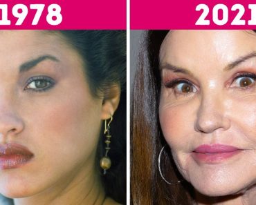 17 fotópár, amelyek megmutatják, hogyan változik a topmodellek arca az idő múlásával