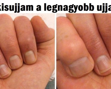15 emberi test vonás, amely egyedivé teszi a tulajdonosát