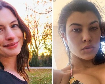 A hírességek megmutatták az arcukat a #Nomakeup Challenge-en, és mi csodáljuk őket