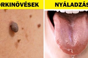 8 váratlan terhességi jel, amelyről talán nem is tudsz