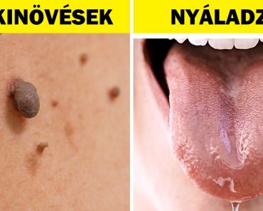 8 váratlan terhességi jel, amelyről talán nem is tudsz