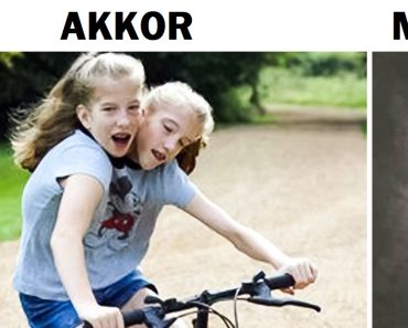 15 érdekes dolog a híres sziámi ikrekről, Abby és Brittany Henselről