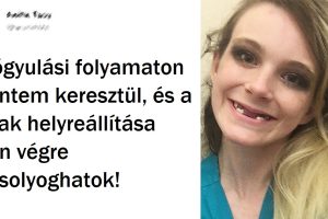 20 ember, akik kemény utat tettek meg az egészséges test felé