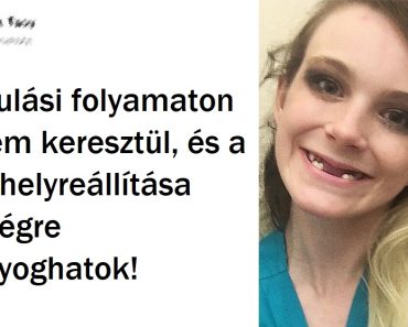 20 ember, akik kemény utat tettek meg az egészséges test felé