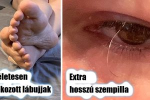16 ember, akiknek a teste olyan, mint egy kincsesláda