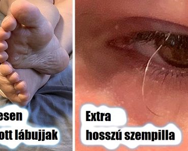 16 ember, akiknek a teste olyan, mint egy kincsesláda