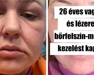 16 ember, akik mertek nagyot változtatni és most nem tudják levenni a szemüket a tükörről