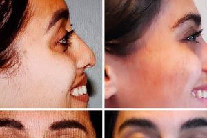 14 ember, akik hatalmas munkát végeztek, hogy megváltozzanak a felismerhetetlenségig