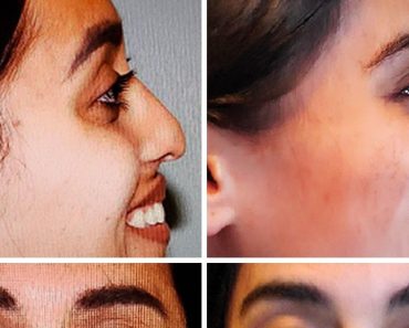14 ember, akik hatalmas munkát végeztek, hogy megváltozzanak a felismerhetetlenségig