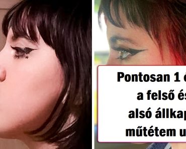 18 ember, akik mertek plasztikai műtétet végeztetni és megütötték a főnyereményt