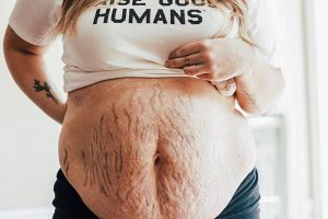 16 nő, akik megmutatták a testüket terhesség után, és mi büszkék vagyunk rájuk