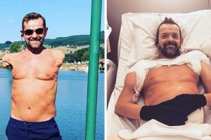 Egy férfi, akinek amputálták a karját és a vállát, újra tud integetni