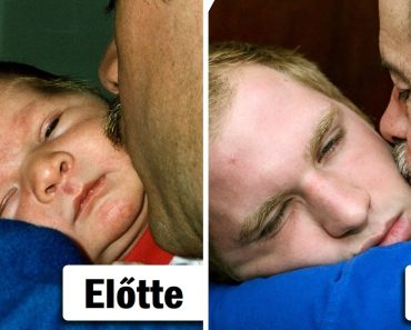 18 előtte-utána kép, amelyek a legélesebb érzéseket kelthetik benned