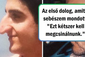18 ember, akik a plasztikai műtétet választották, hogy megváltoztassák a kinézetüket és javítsanak az önbecsülésükön