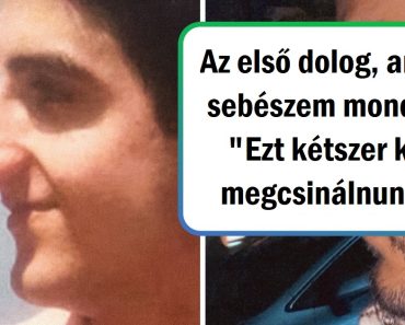 18 ember, akik a plasztikai műtétet választották, hogy megváltoztassák a kinézetüket és javítsanak az önbecsülésükön