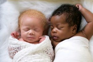 A fényképésznő ikreket szült, egy színes bőrűt és egy albínót – szerintem gyönyörűek!