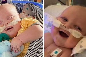 A baba, aki túlélt 2 nyitott szívműtétet, először mosolyog a kórházban