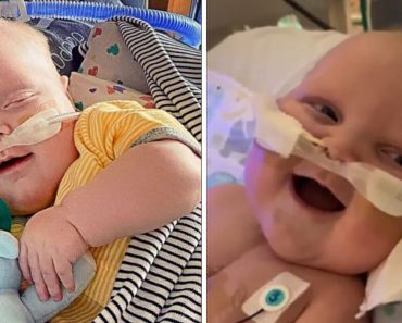 A baba, aki túlélt 2 nyitott szívműtétet, először mosolyog a kórházban