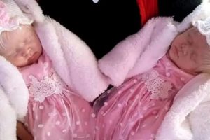Hófehér hajú ikreket szült az anya, évekkel később is megmutatják szokatlan szépségüket