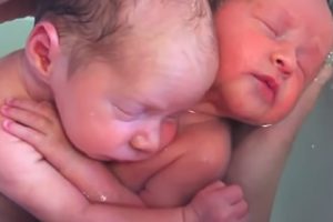 Az újszülött ikrek nem veszik észre, hogy megszülettek, és nem hajlandók abbahagyni az ölelkezést, ahogy az anyaméhben is tették