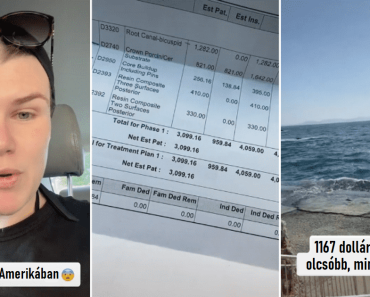 A nő Törökországba repül, hogy ne kelljen 3000 dollárt fizetnie egy gyökérkezelésért az Egyesült Államokban, és 1800 dollárt spórol meg