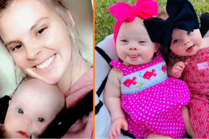 A ritka Down-szindrómás ikrek anyukája megmutatja, milyen szépek a gyermekei a kritikák ellenére is