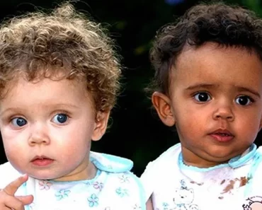 A nővérek, akik születésükkor majdnem egyformának tűntek, különböző bőrszínnel nőttek fel