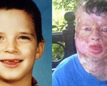 A 8 éves fiú, aki szörnyű égési sérüléseket szenvedett, megnevezte azt a szörnyeteget, aki megerőszakolta és felgyújtotta őt
