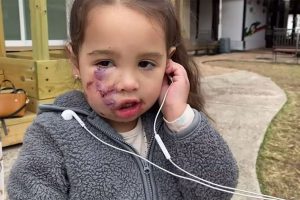 A 3 éves kislányt “kegyetlenül” megtámadta az étteremben egy szolgálati mellényt viselő kutya
