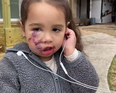 A 3 éves kislányt „kegyetlenül” megtámadta az étteremben egy szolgálati mellényt viselő kutya