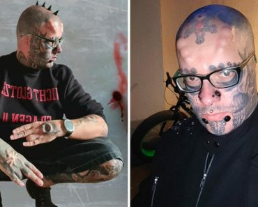 Sandro eltávolíttatta a fülét, hogy úgy nézzen ki, mint egy koponya.