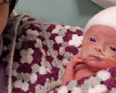Az anyának azt mondták, hogy a baba meghalt az anyaméhben, és hetekkel később megszülte a fiát Az anyának azt mondták, hogy a baba meghalt az anyaméhben, és hetekkel később megszülte a fiát
