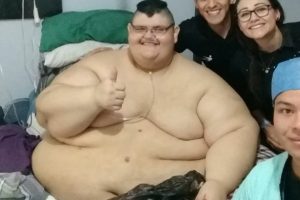A világ legkövérebb embere 300 kiló fogyással változtatja meg az életét – gyönyörű átalakulással felismerhetetlenné válik