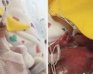Egy évvel ezelőtt születtek meg a világ legkoraszülöttebb ikrei – itt vannak ma