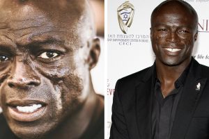 Seal több mint 30 éve viseli arcán a védjegyévé vált hegeit – ez az oka