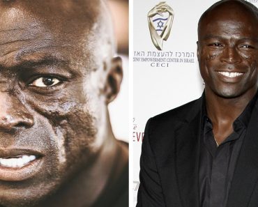 Seal több mint 30 éve viseli arcán a védjegyévé vált hegeit – ez az oka