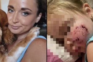 Az anya úgy dönt, hogy megtartja a kutyát, miután az szétmarcangolta a három éves lánya arcát, és sebhelyeket hagyott rajta