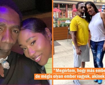„Nem tudja megcsókolni”: Az állkapocs nélküli férfi megtalálja a szerelmet, miután megfélemlítették, de az emberek mégis elítélik a kapcsolatukat