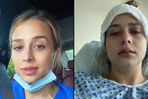 A 24 éves nőnél 3. stádiumú rákot diagnosztizáltak, miután figyelmen kívül hagyta a folyamatos böfögést