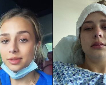 A 24 éves nőnél 3. stádiumú rákot diagnosztizáltak, miután figyelmen kívül hagyta a folyamatos böfögést A 24 éves nőnél 3. stádiumú rákot diagnosztizáltak, miután figyelmen kívül hagyta a folyamatos böfögést