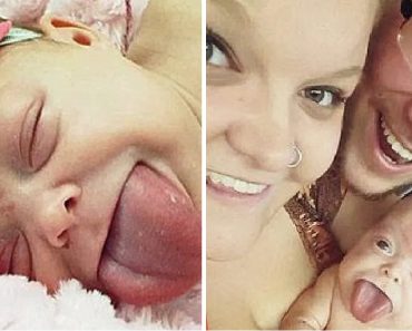 Az anyuka hatalmas, életveszélyes nyelvvel hozta világra a babát — egy év múlva végre mosolyog a kisfiú