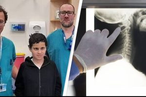 Az orvosok sikeresen visszavarrják a fiú fejét, miután lefejezték egy autóbalesetben
